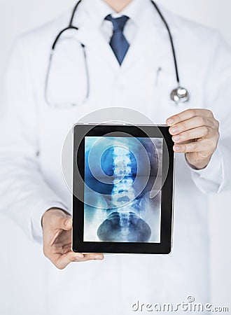 Male doctor holding tablet pc with x-ray