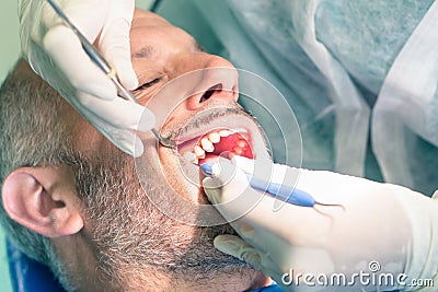 Male patient during dental hygiene at dentist office