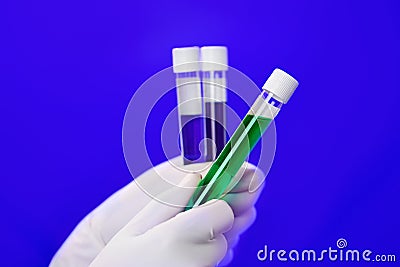 Medical test tubes with fluid sample