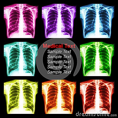 Multicolored chest x-ray background