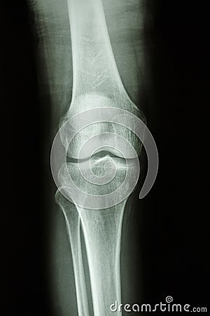 Normal human s knee joint