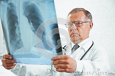 Older doctor examines x-ray image of lungs