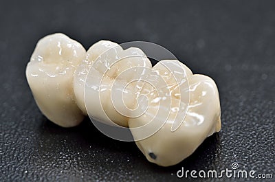 Porcelain dental crown