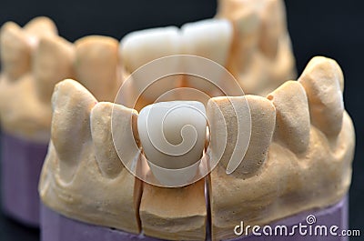 Porcelain teeth on dentures models