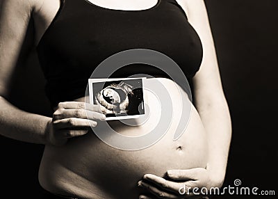 Pregnant woman holding an ultrasound scan