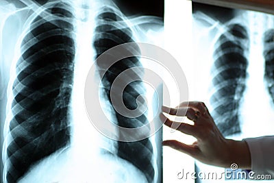 Radiography