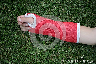 Red wrist arm and hand cast