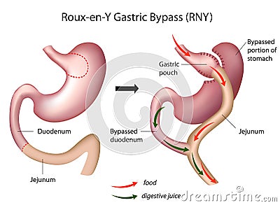 Gastric Mucosa Royalty Free Stock Photo - Ima