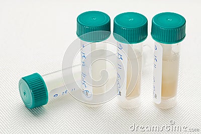 Saliva samples for laboratory test