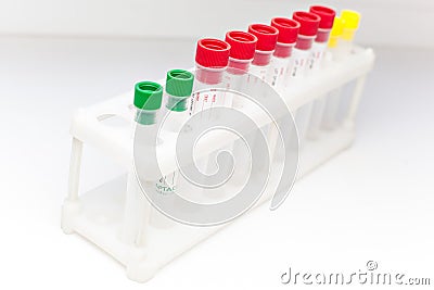 A set of medical test tubes on white background, vials