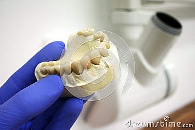 Set of teeth model (chop) held in left hand with dental x-ray tube head in background