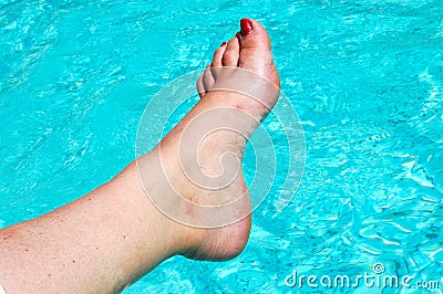 Sore foot