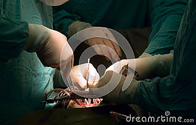 Surgeon s hands at work