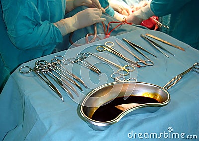 Surgeons, instruments, operation.