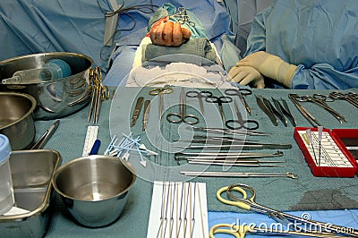 Surgery-Hand Operation