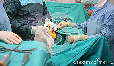 Surgical operation