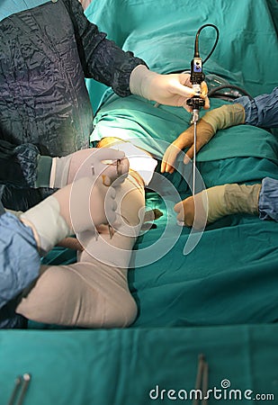 Surgical operation