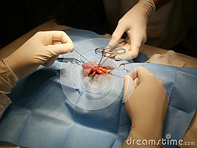 Surgical removal of ovaries