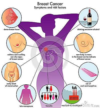 Symptoms and risk factors of Breast Cancer