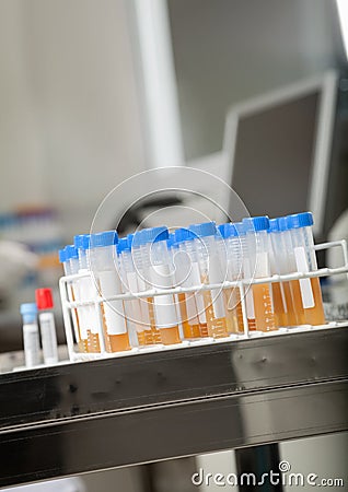 Test Tubes In Medical Laboratory