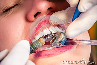 Treatment at the dentist s