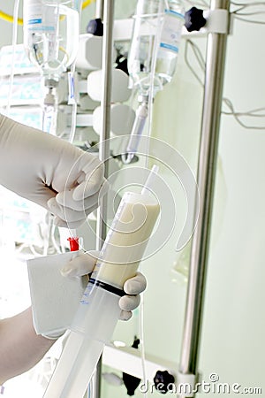 Tube feeding patient in the ICU