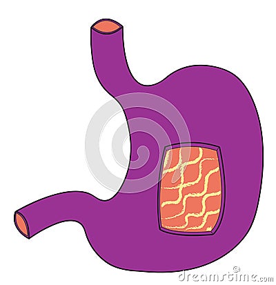 Ultraviolet stomach