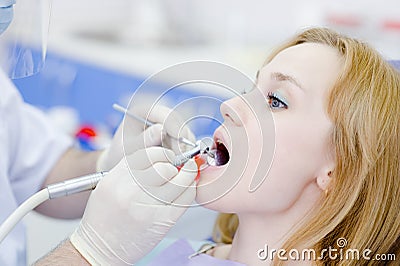 Woman with open mouth during drilling treatment at the den