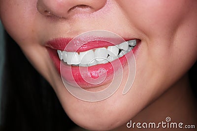 Woman smile with white teeth