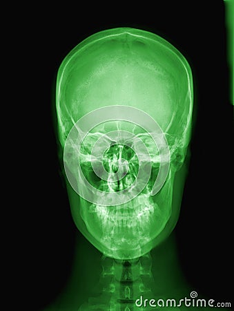 X-ray of Alien s skull.