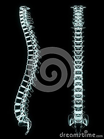 X-ray spine front and side