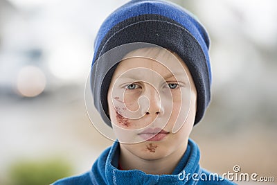 Young boy with a face injury