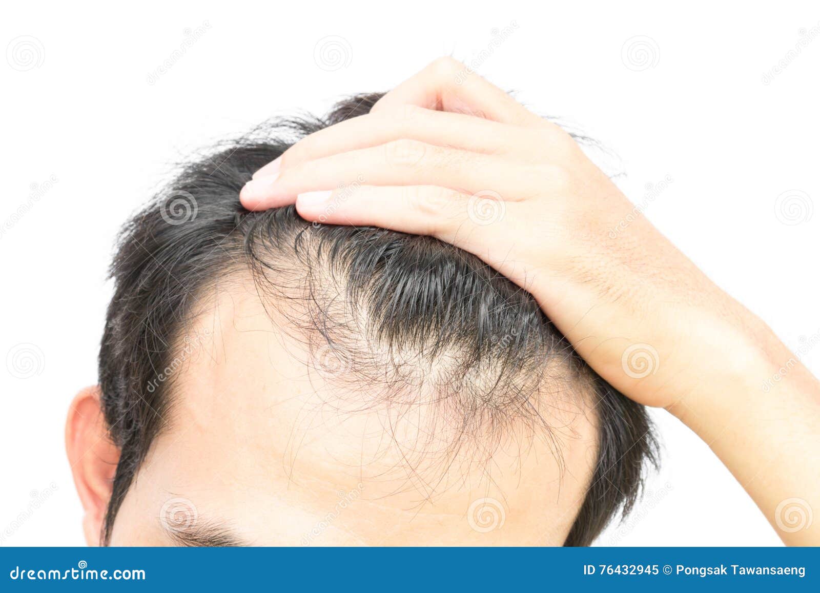 Men Paraben-Free Hair Loss Treatments eBay M - Safest Place To Buy Cialis Online