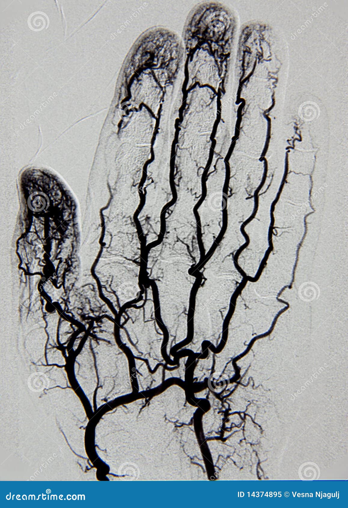 Exame de arteriografia