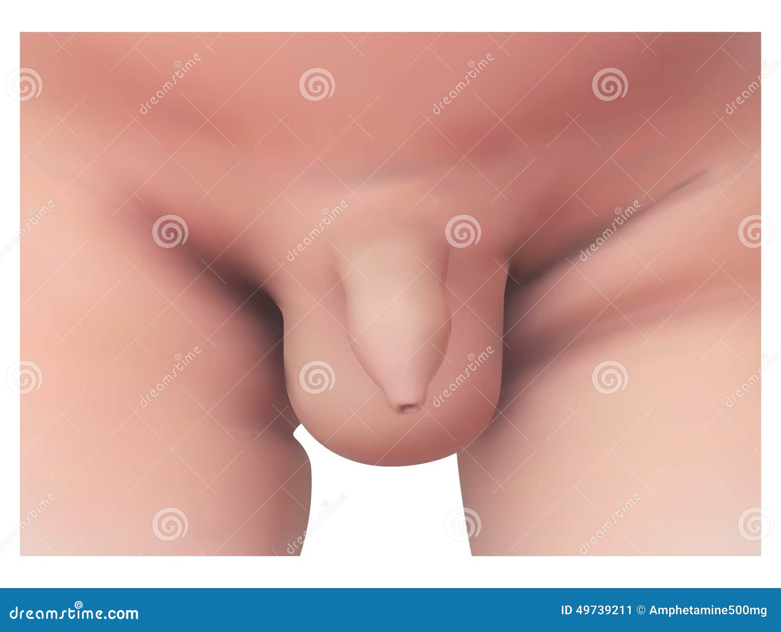 Penis Of Baby 120