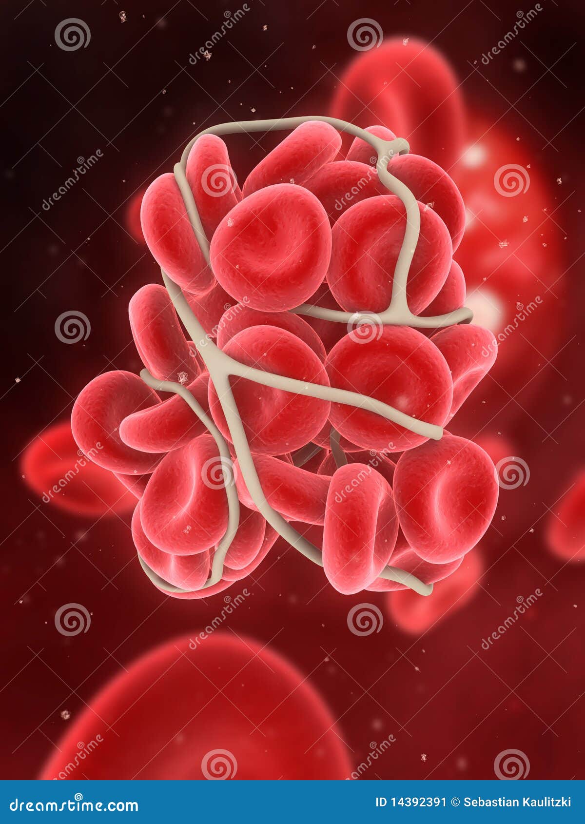 blood clot clipart - photo #27