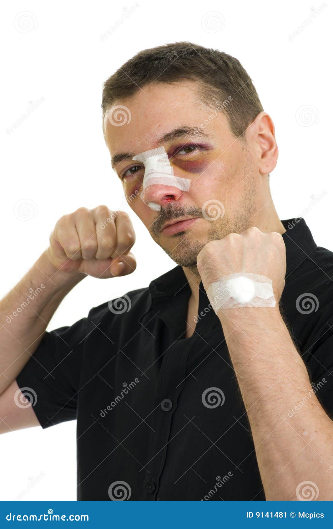 Broken Nose Post Operation Stock Image Image 9141481