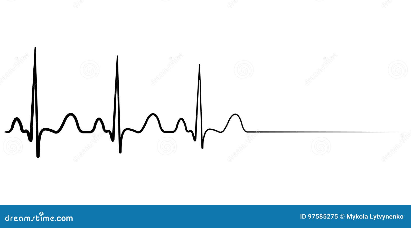 How to Choose a Treatment for Arrhythmia How to Choose a Treatment for Arrhythmia new images How to Choose a Treatment for Arrhythmia How to Choose a Treatment for Arrhythmia new picture