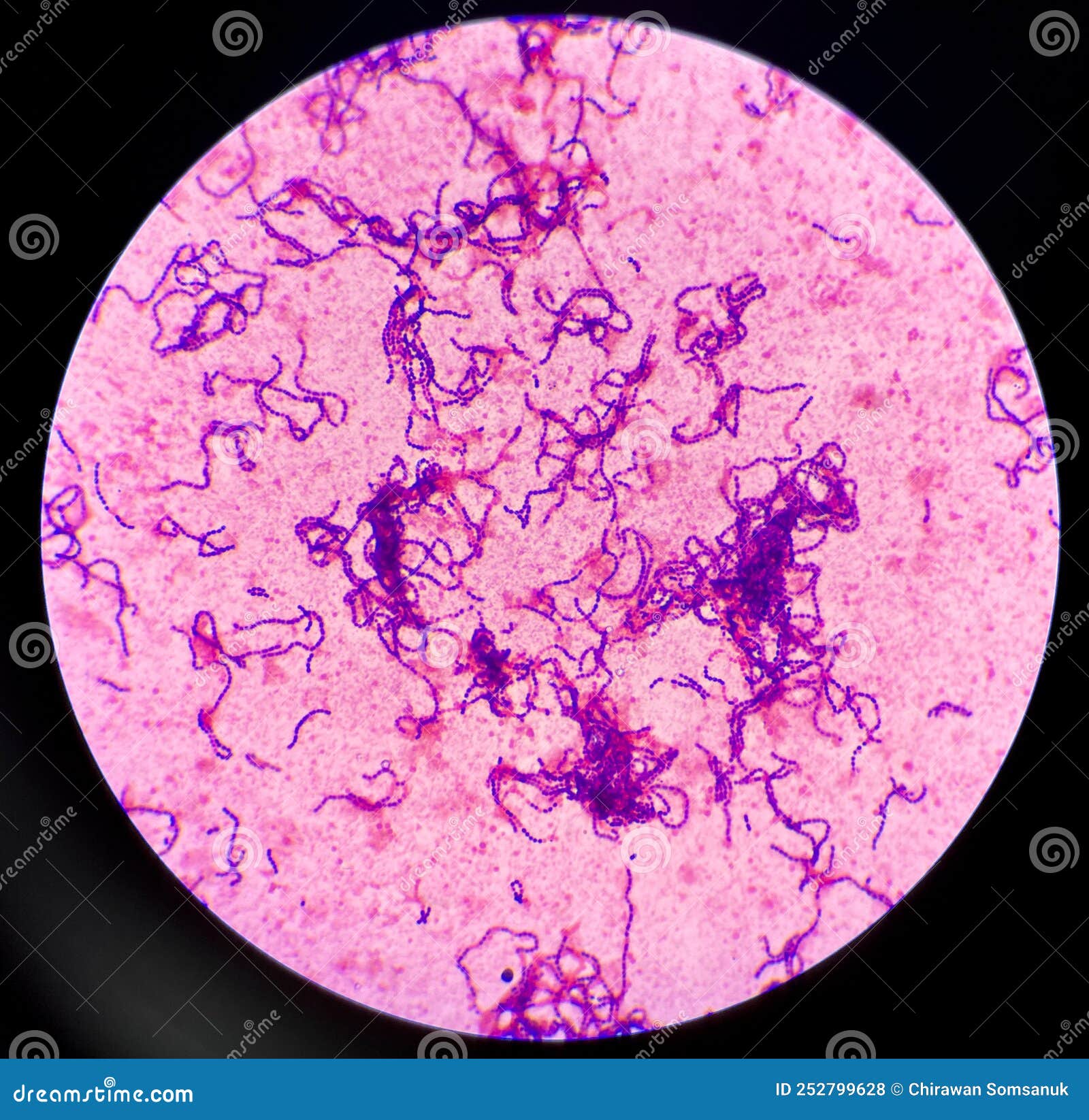 Gram Positive Cocci In Chain Stock Photography Cartoondealer