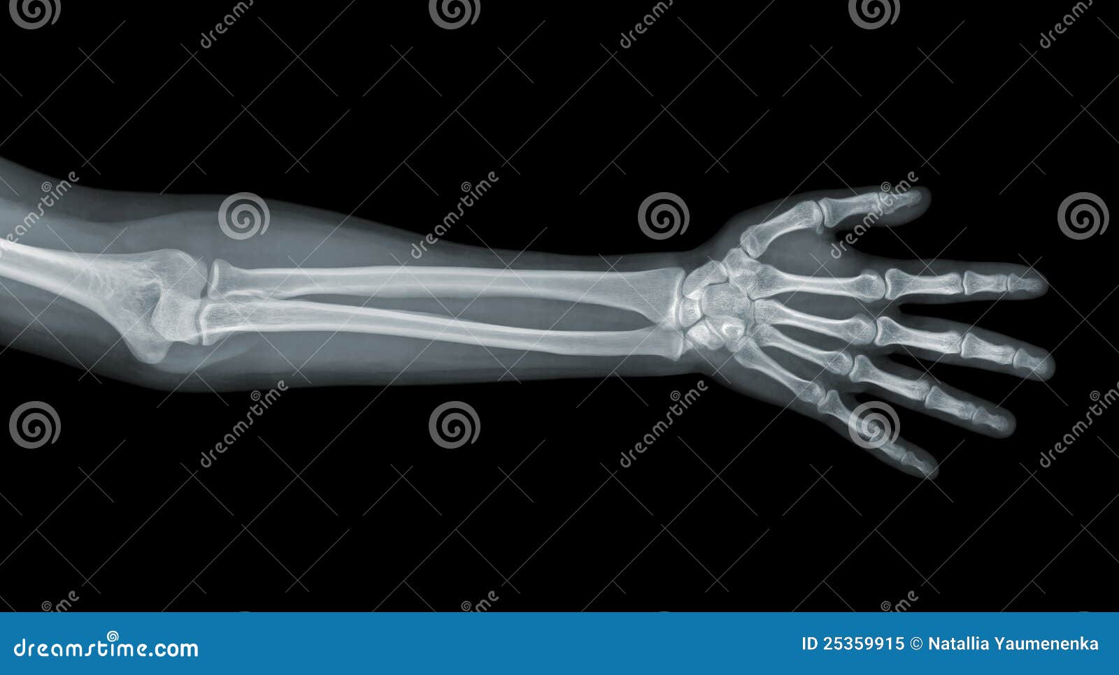 hand x ray clipart - photo #43