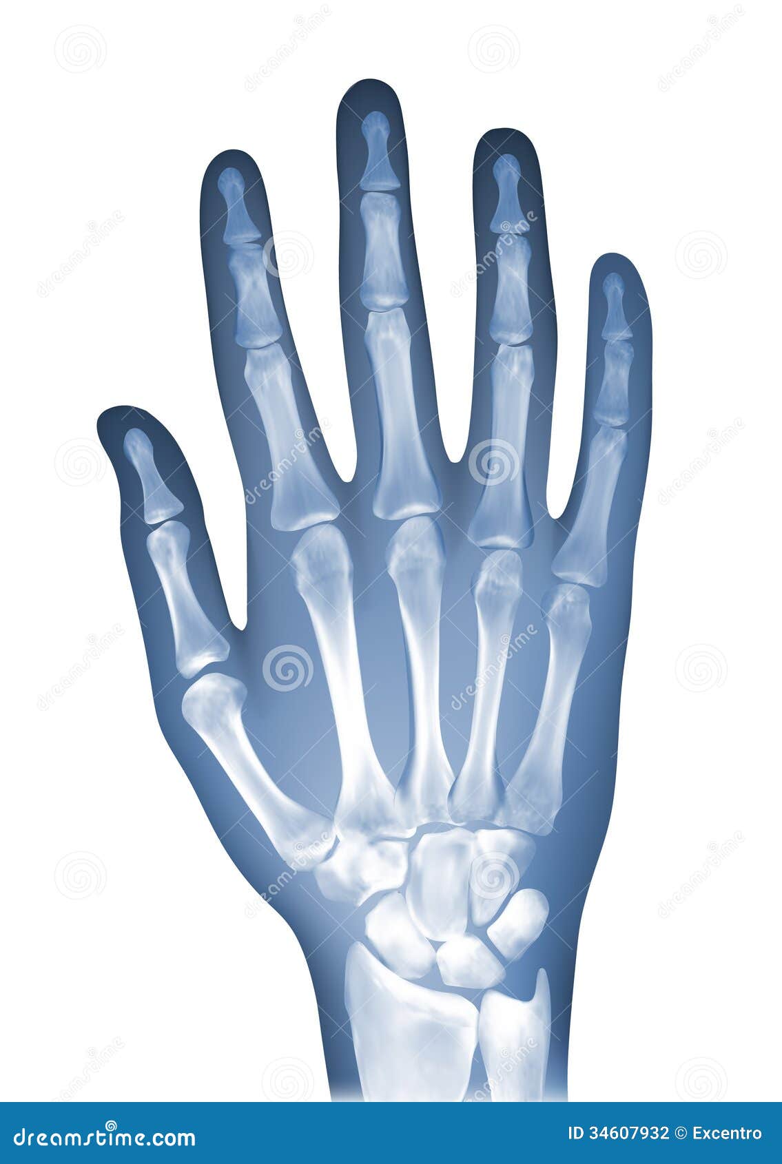 hand x ray clipart - photo #31