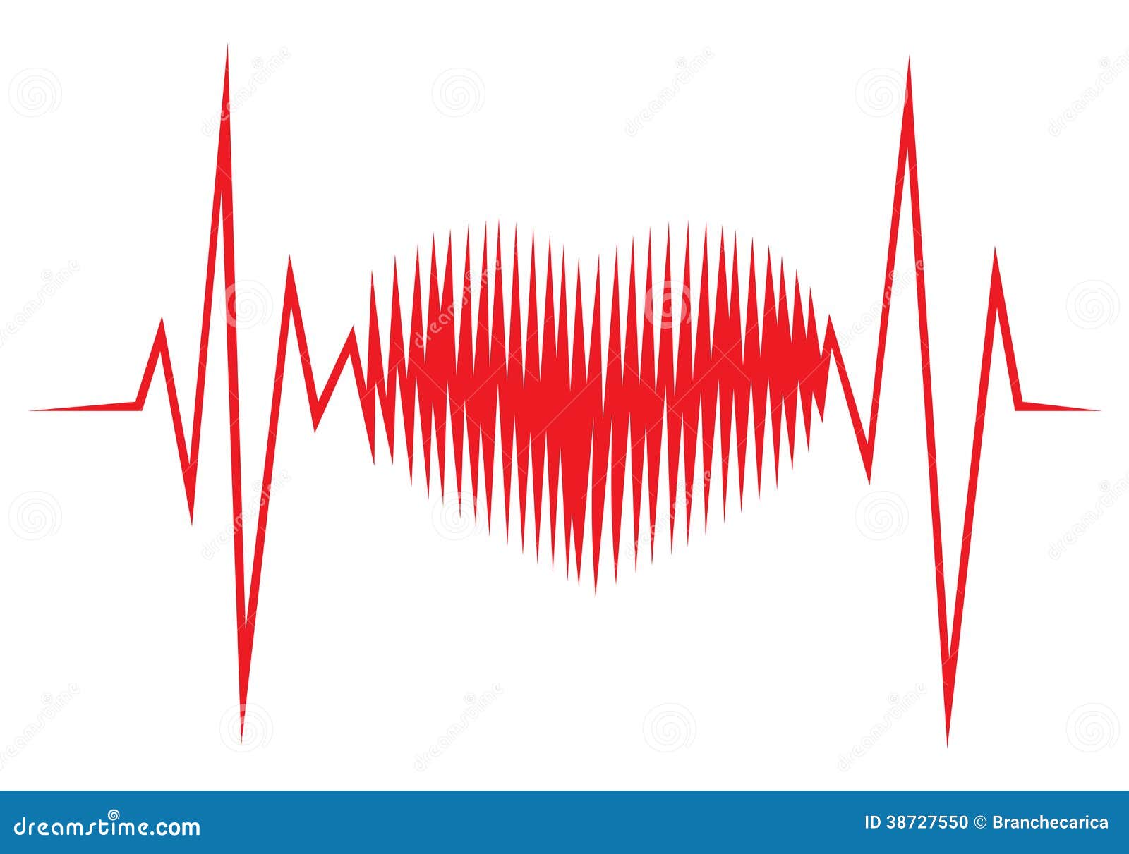 cardio hartslag