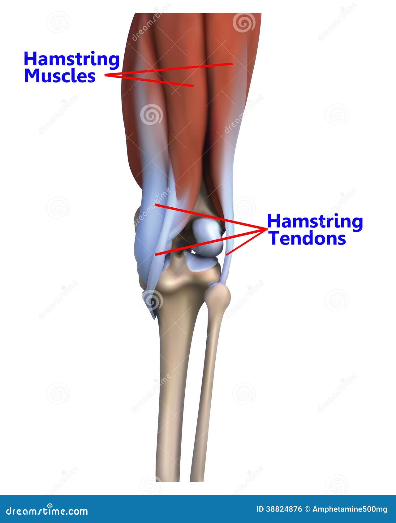 Tendinitis rodilla posterior