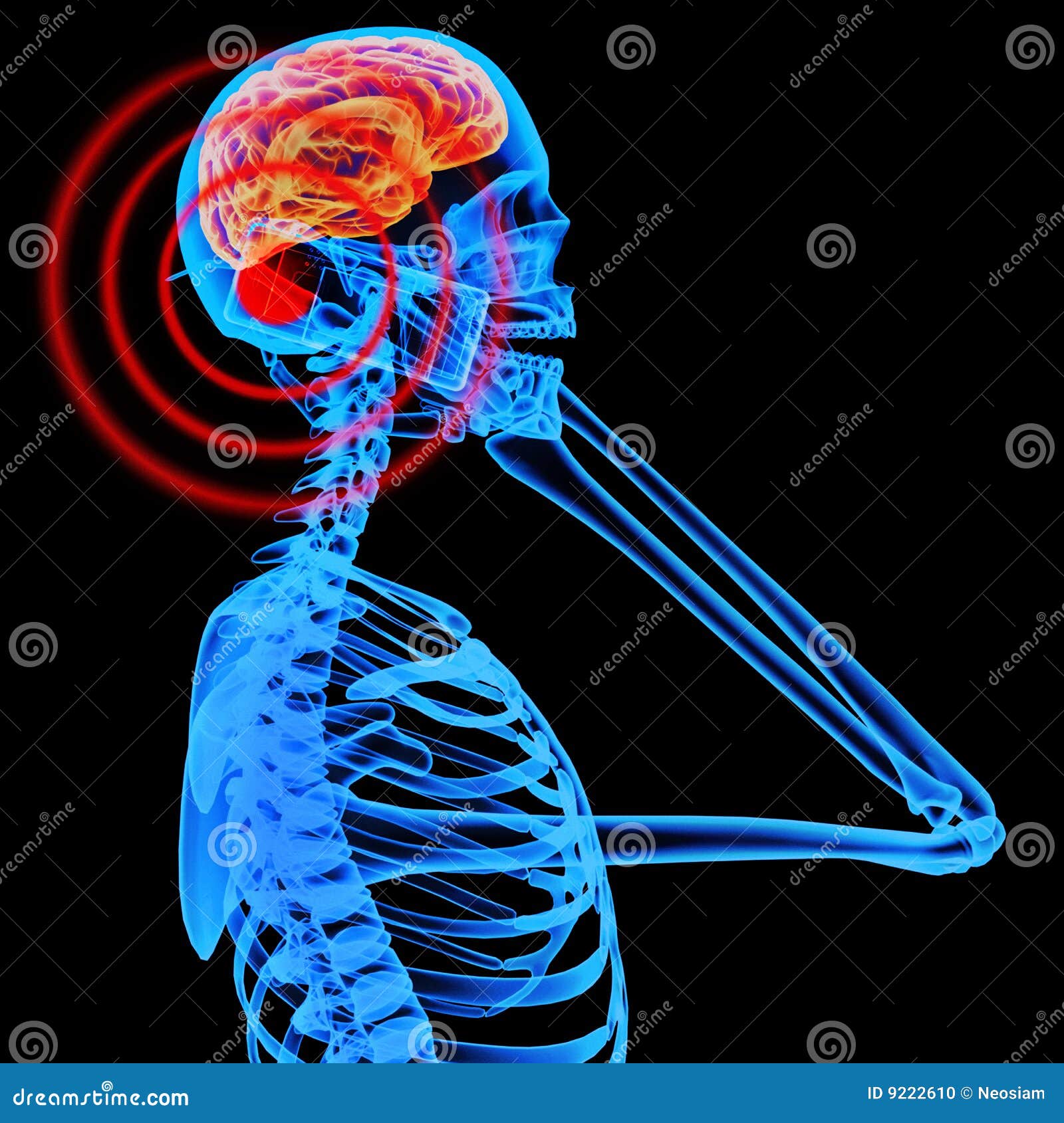 download mitochondrial disorders in neurology butterworth heinemann international medical reviews 1994