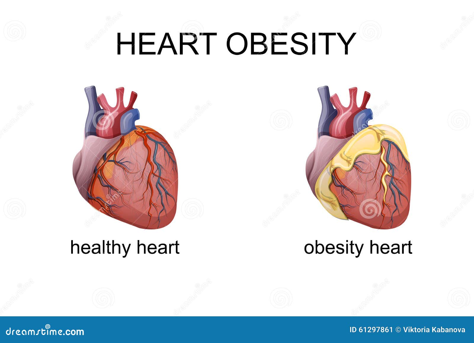 Illustration on obesity