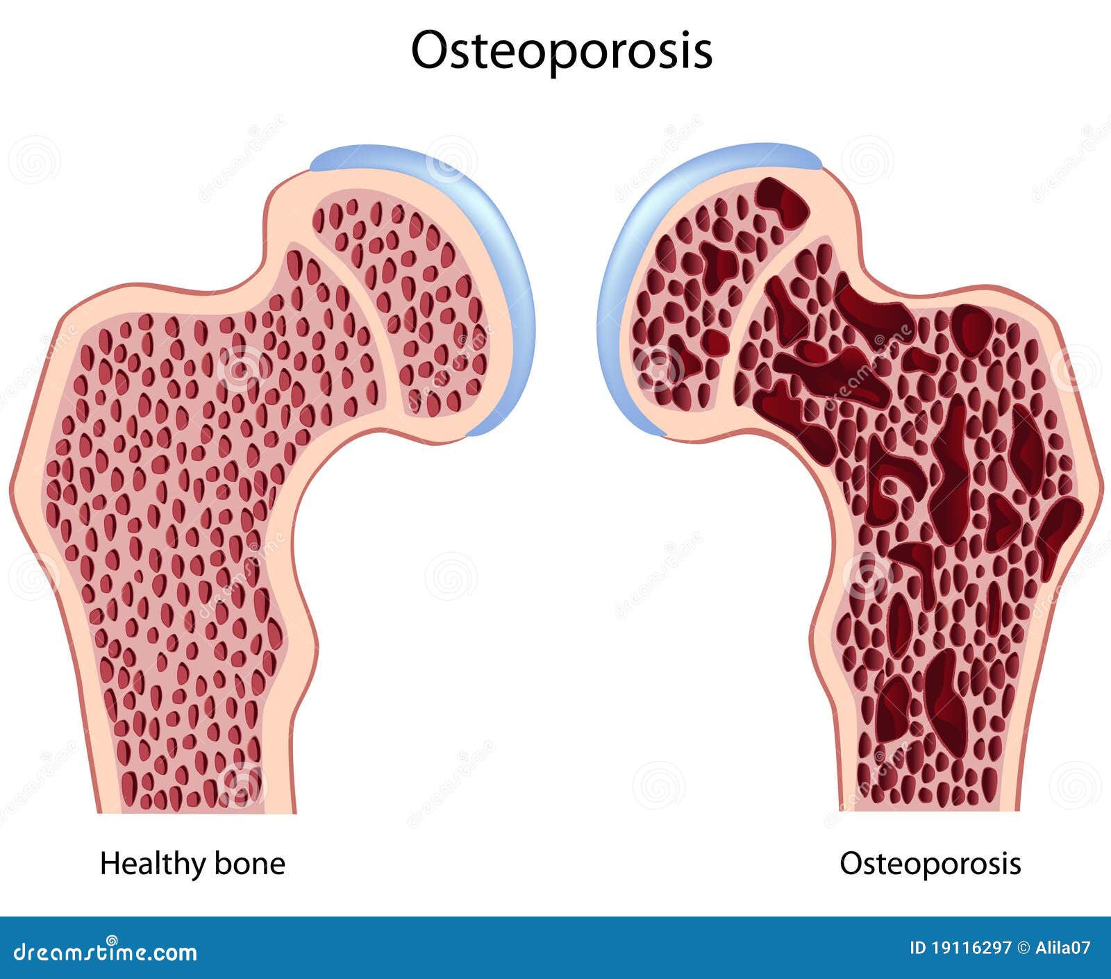 book das knie der ratgeber für das verletzte knie diagnostik therapie und rehabilitation bei verletzungen des kniegelenks