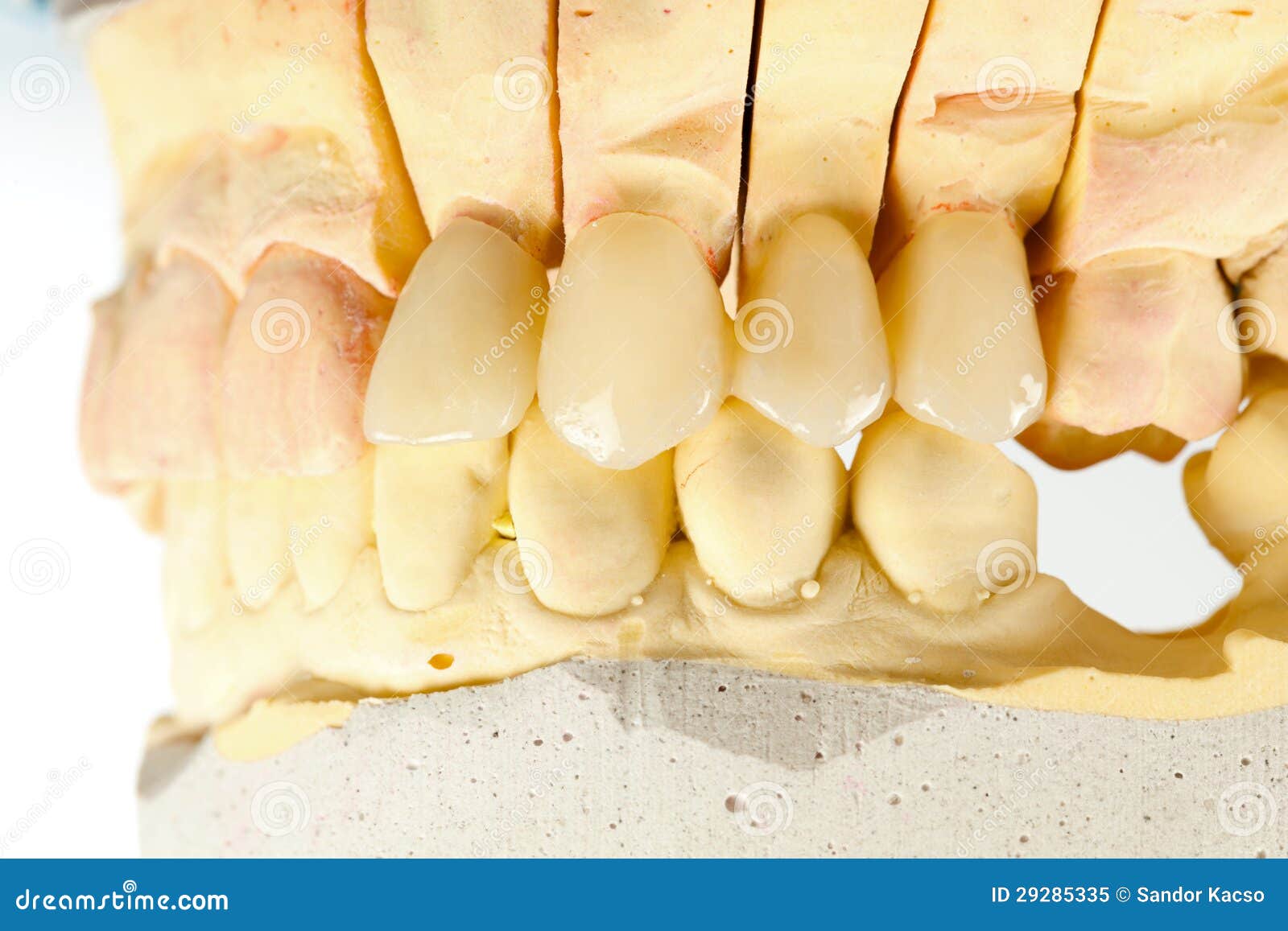 Pressed Ceramic Teeth Royalty Free Stock Photo Image 29285335