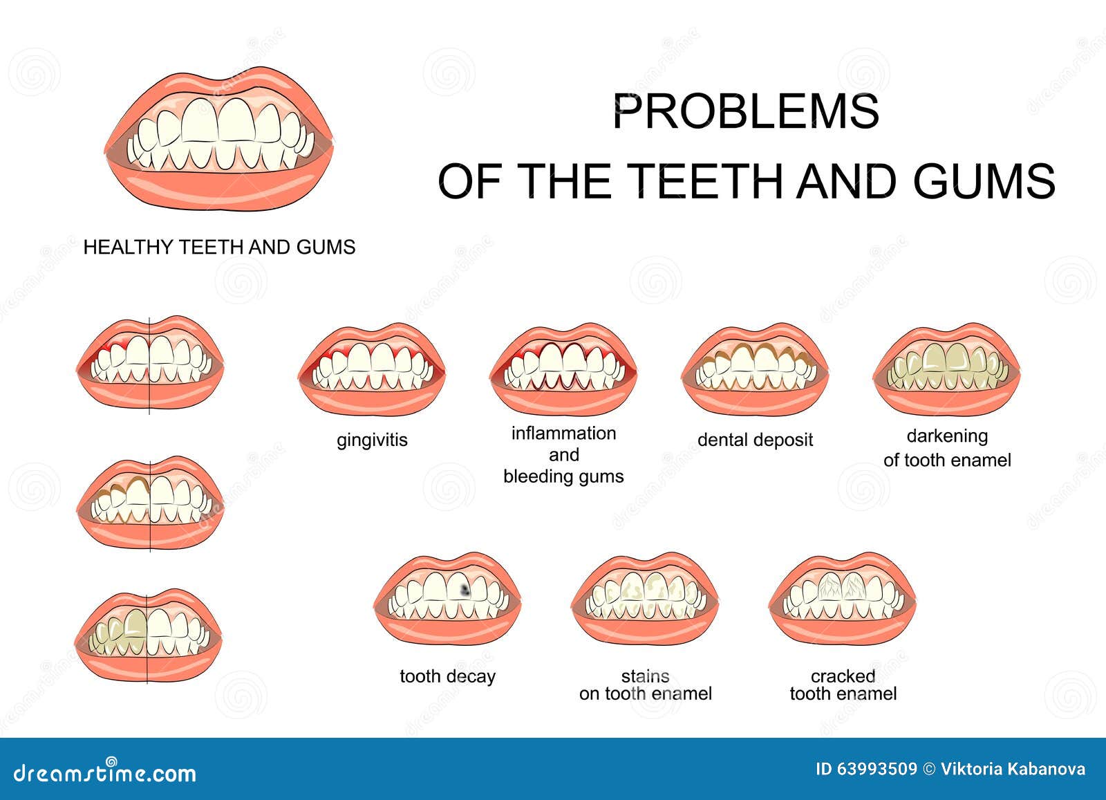 Oral Reading Errors 49