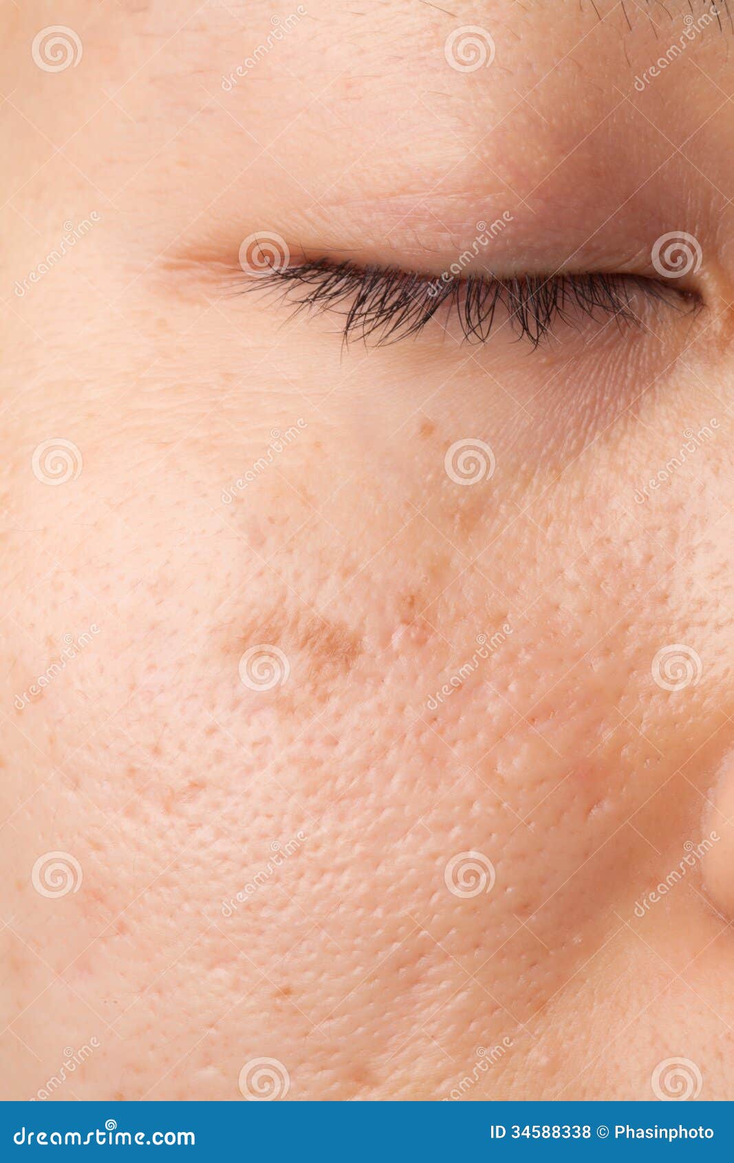 Skin Problem - Het CosmeticaHuis