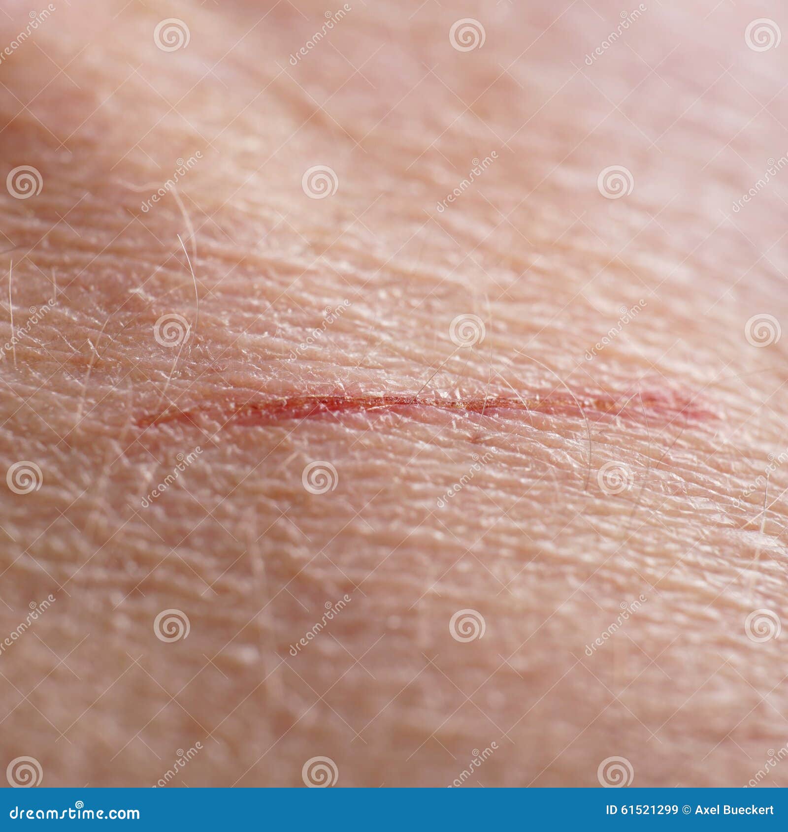 texture of human skin and scratch up macro stock photo royalty free image skin cut macro stock photo image 61521299 texture of human skin and scratch up macro stock photo royalty free image skin cut macro stock photo image 61521299